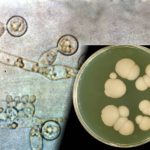 candida-albicans-mikrobu